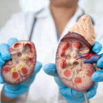 How does liver impact skin health