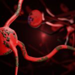 What is neuroparhy